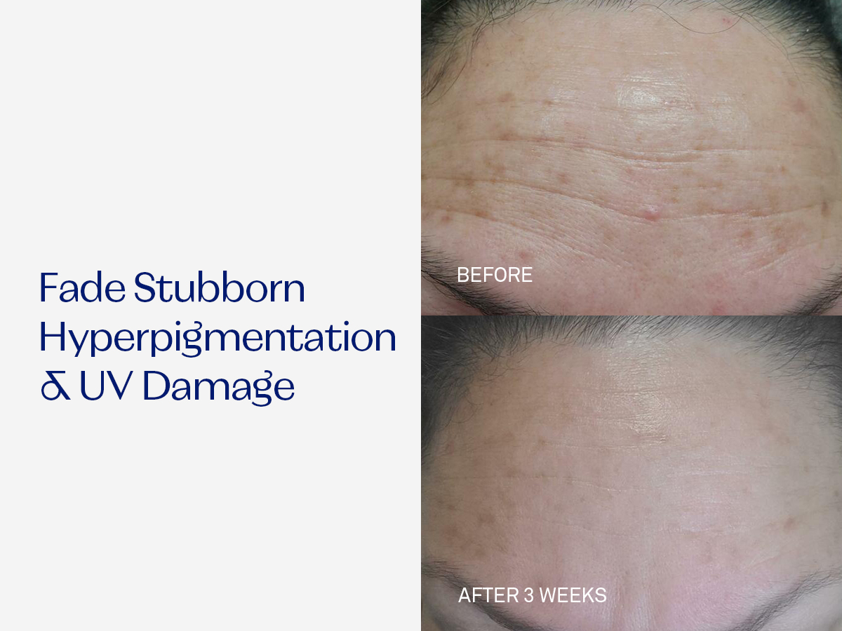 RescueMD DNA Repair Complex Scar Treatment Serum, Redness and Skin Damage Solution, 30mL