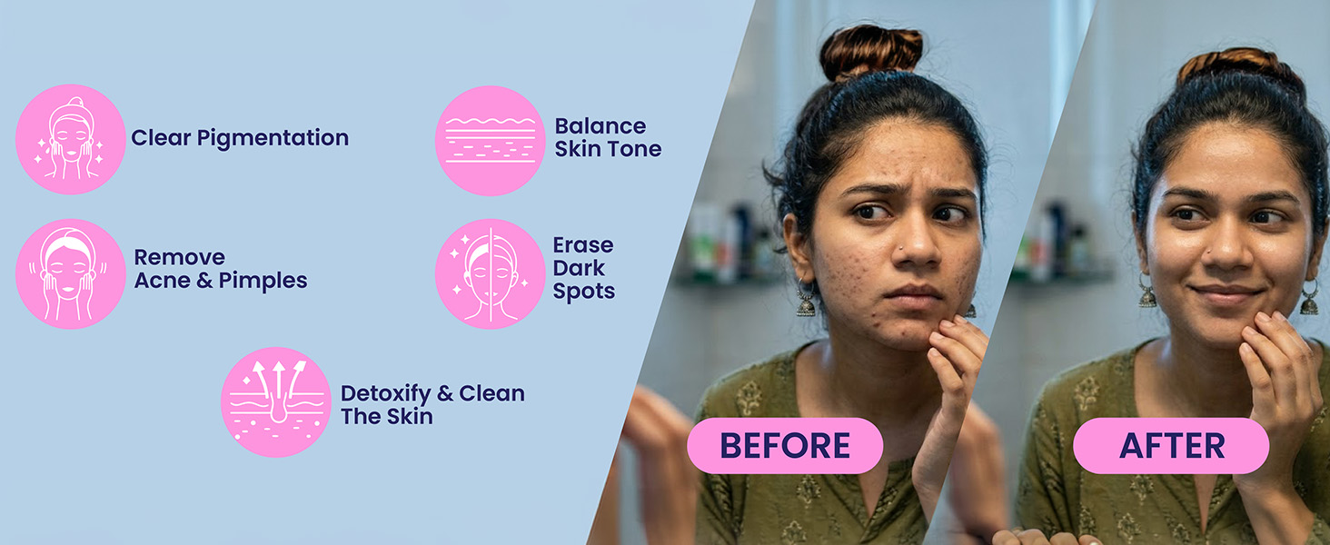 Anti Acne Ultimate Combo | Anti-Acne Pro + Multi Collagen Pro + Super Greens Pro + Glutathione Pro | Clear Skin, Glow & Skin Wellness Support