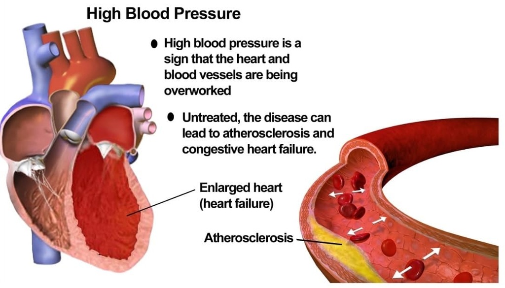 pressure-guard-the-complete-all-natural--4.jpg