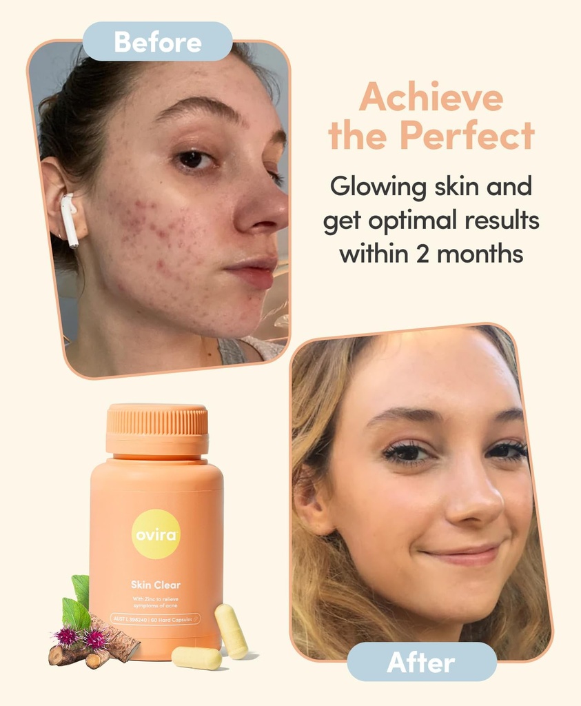 ovira-skin-clear-with-zincbright-60-caps-5.jpg