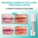 ishancare-cold-sore-treatment-cream-fast-5.jpg