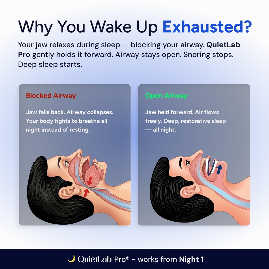 quietlab-pro-anti-snoring-mouthpiece-adj-3.jpg