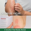 green-leaf-naturals-manuka-honey-eczema--4.jpg