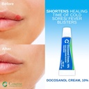 cosette-cold-sore-fever-blister-treatmen-2.jpg