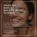 dermawonder-vitiligo-capsules-60-count-e-2.jpg
