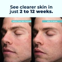 vitamedica-clear-skin-vitamin-formula-no-4.jpg