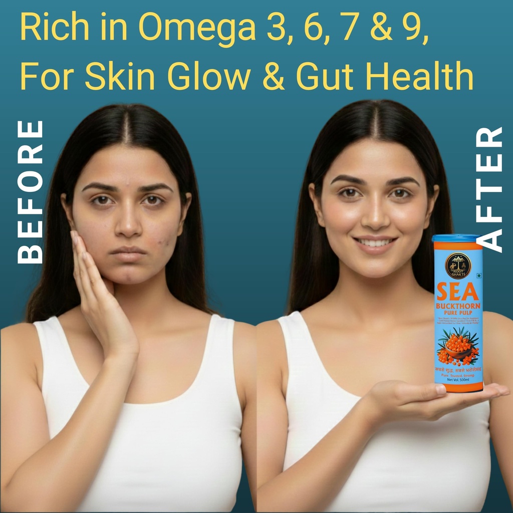 root-shakti-naturals-sea-buckthorn-juice-81LkZ7bpo+L.jpg