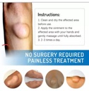 lipoma-removal-cream-mild-easy-to-use-ca-61X6BncHqjL.jpg