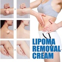 lipoma-removal-cream-whole-body-lipoma-l-61DlB1K-h1L.jpg