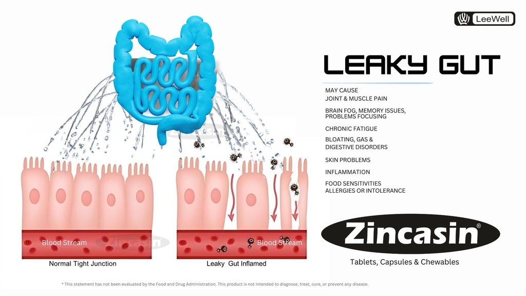 zincasin-leewell-zinc-carnosine-tablets--71OkIUJx-GL.jpg