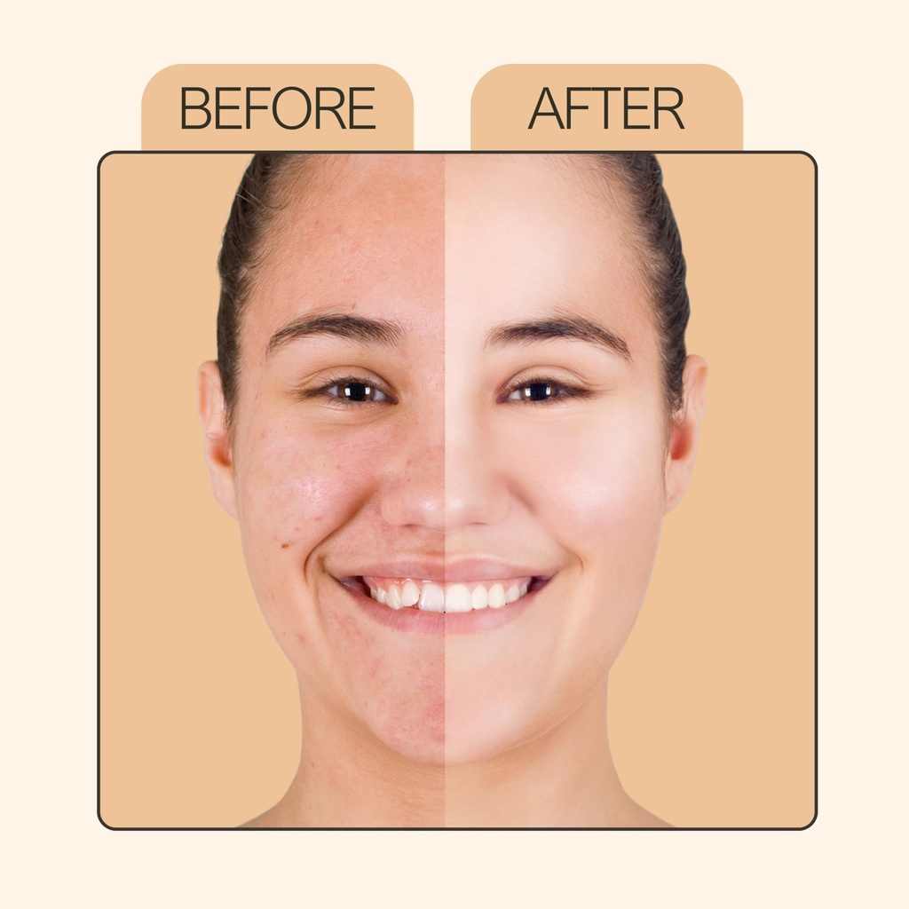 vitamin-c-face-serum-10ml-with-niacinami-715uAkYXOyL.jpg