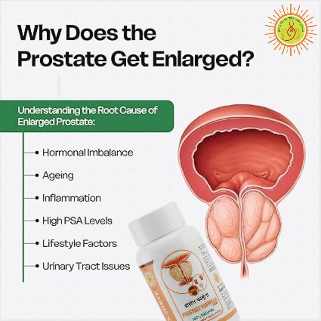 prostate-formula-herbal-supplement-for-p-61j578wTyvL.jpg