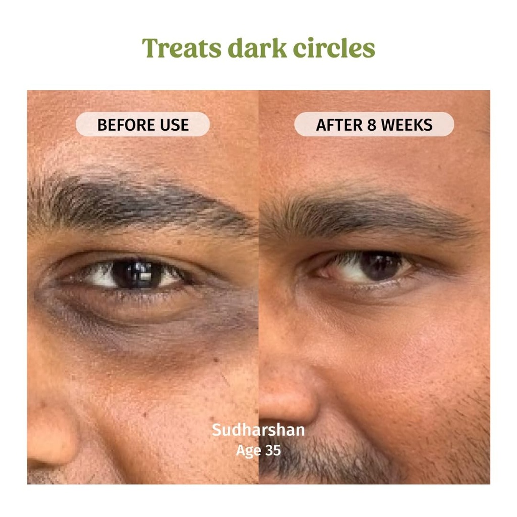 vilvah-under-eye-cream-reduces-dark-circ-61OqXoXUd4L.jpg