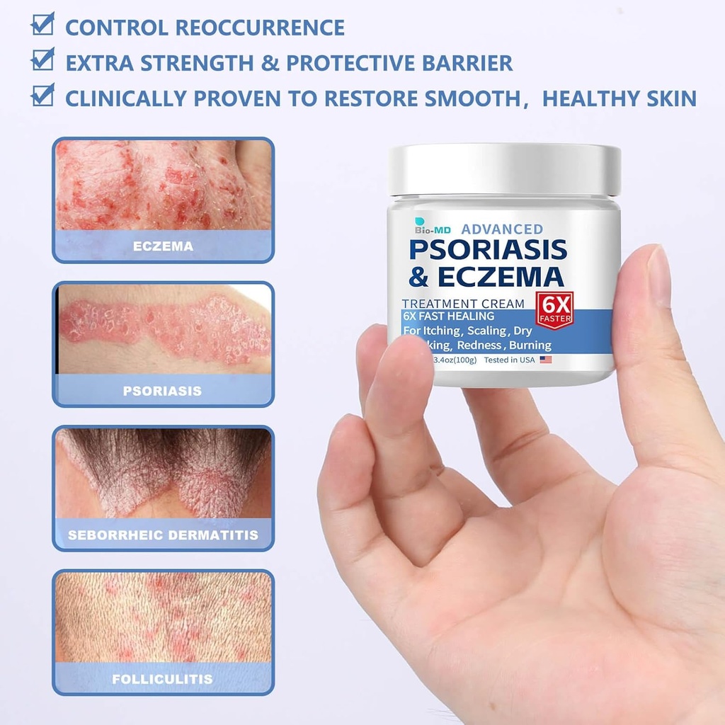 bio-md-psoriasis-eczema-cream-eczema-cre-2.jpg
