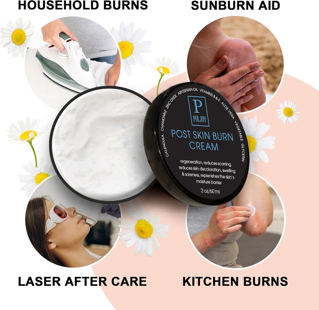 post-skin-burn-cream-sunburn-cream-for-f-4.jpg