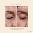 vegamour-gro-lash-serum-eyelash-enhancer-5.jpg