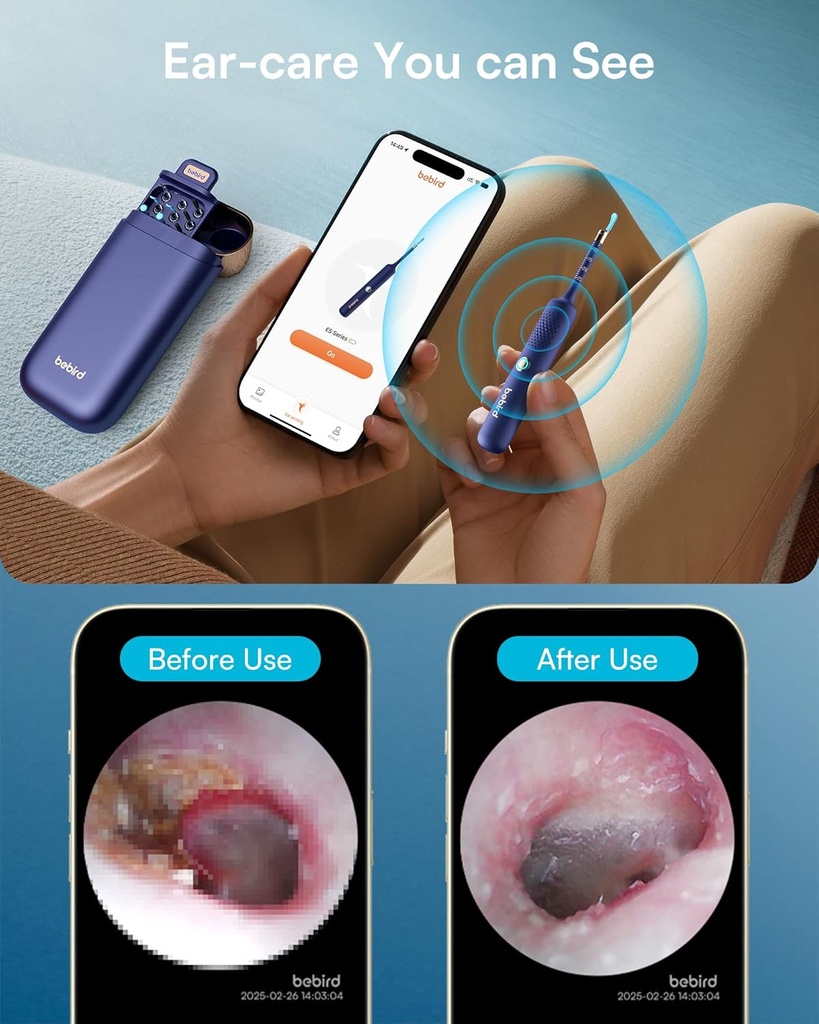 bebird-flexible-ear-wax-removal-tool-cam-5.jpg