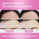 forehead-wrinkle-patches-smoothing-overn-6.jpg