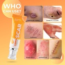 abera-scar-removal-cream-for-women-and-m-2.jpg