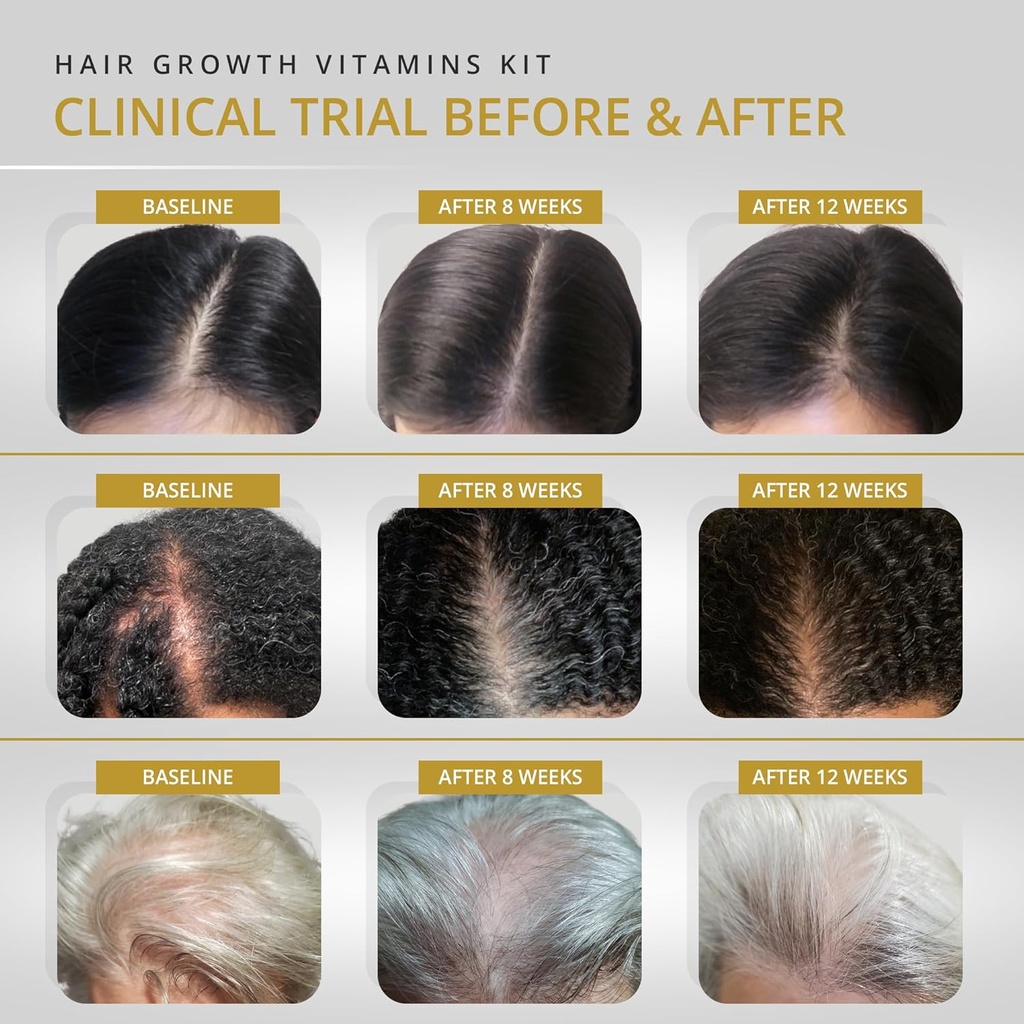 vitamins-revive-hair-supplement-hair-gro-3.jpg