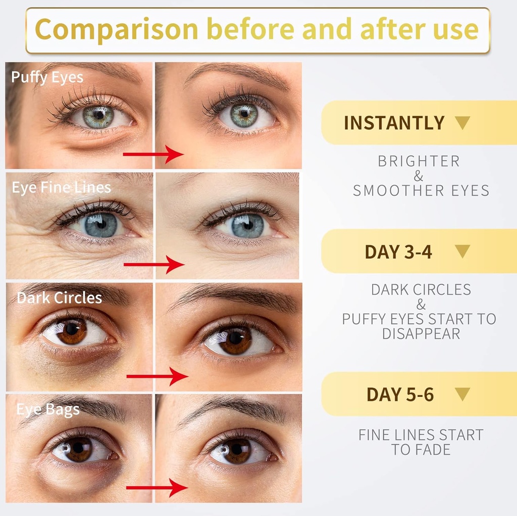 24k-gold-under-eye-patches---60-pack-for-3.jpg