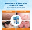 hermon-powerful-antifungal-ringworm-crea-3.jpg