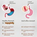 acid-indigestion-relief-safe-antacid-alt-6.jpg
