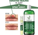all-natural-eczema-treatment--psoriasis--6.jpg