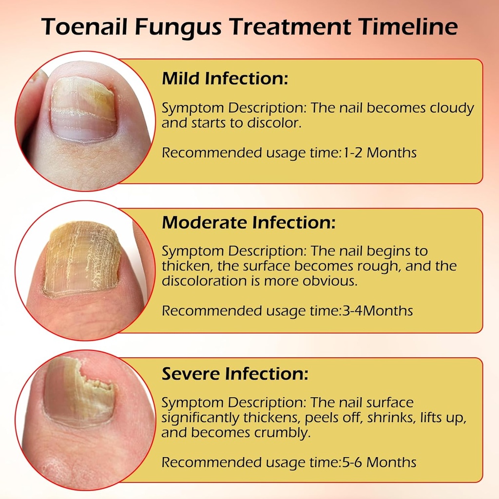 toe-nail-fungus-treatments-for-toenail-n-4.jpg