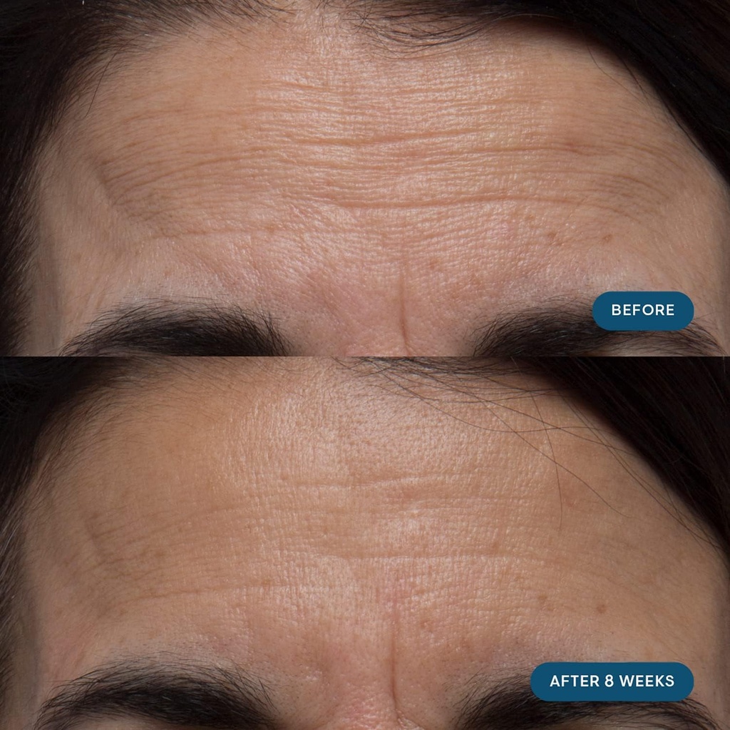 elemis-pro-collagen-skin-future-suppleme-3.jpg