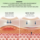 silicone-scar-sheets-clear-silicon-gel-s-3.jpg