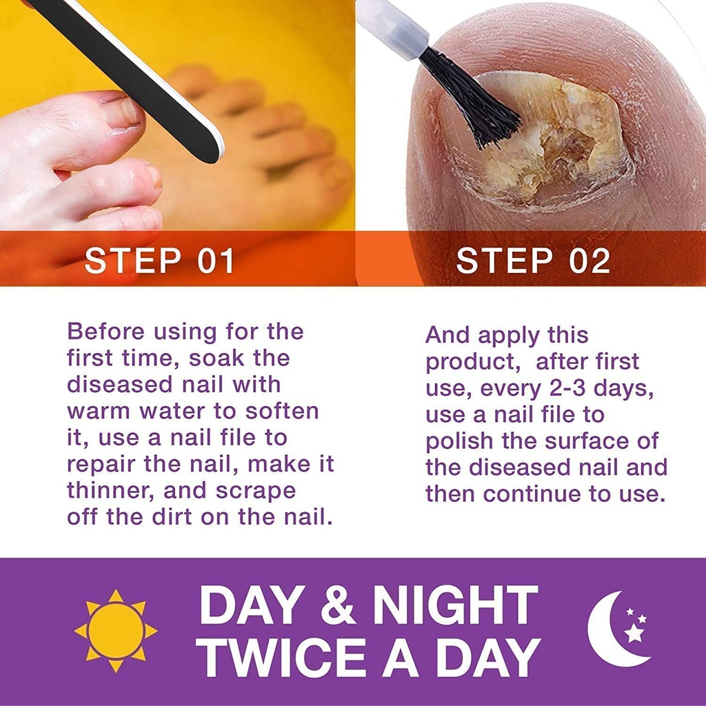 toenail-fungus-revitalizer-for-toenail-f-4.jpg