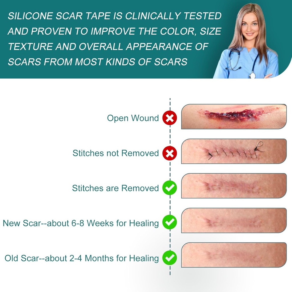 silicone-scar-sheets-16x-79-roll-2m-sili-6.jpg