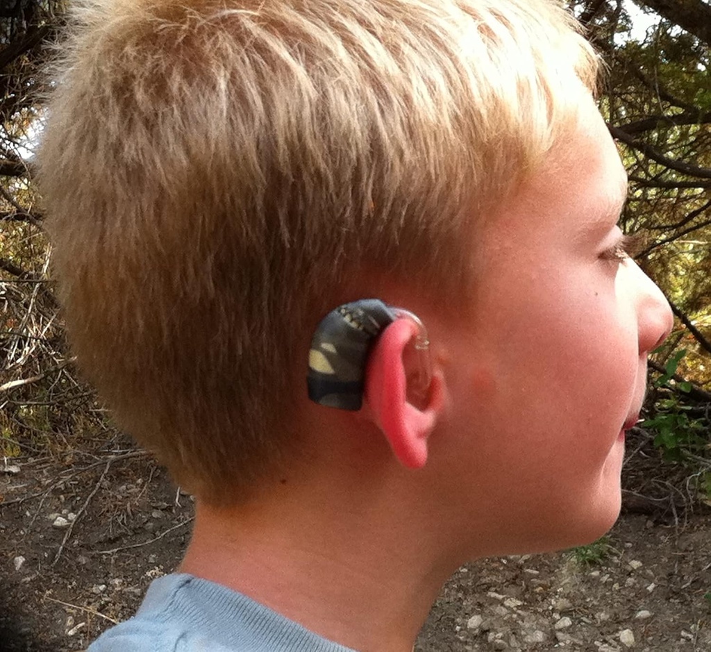 ear-gear-micro-cordless-protect-hearing--5.jpg