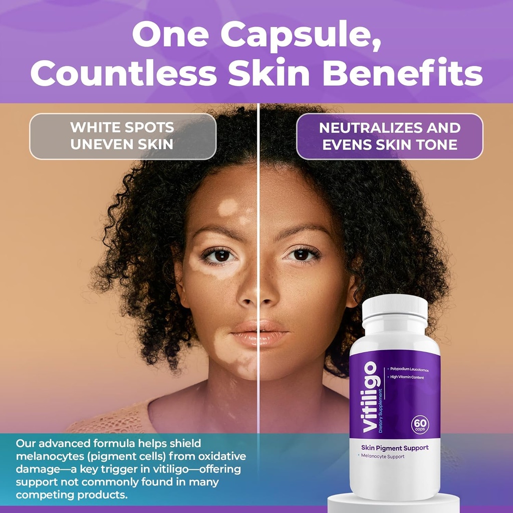 vitiligo-capsules-60-count-1-month-impro-6.jpg