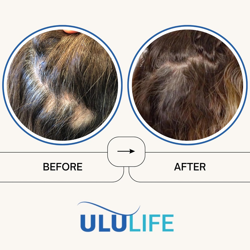 ultimate-regrow-multivitamin-promotes-ha-3.jpg