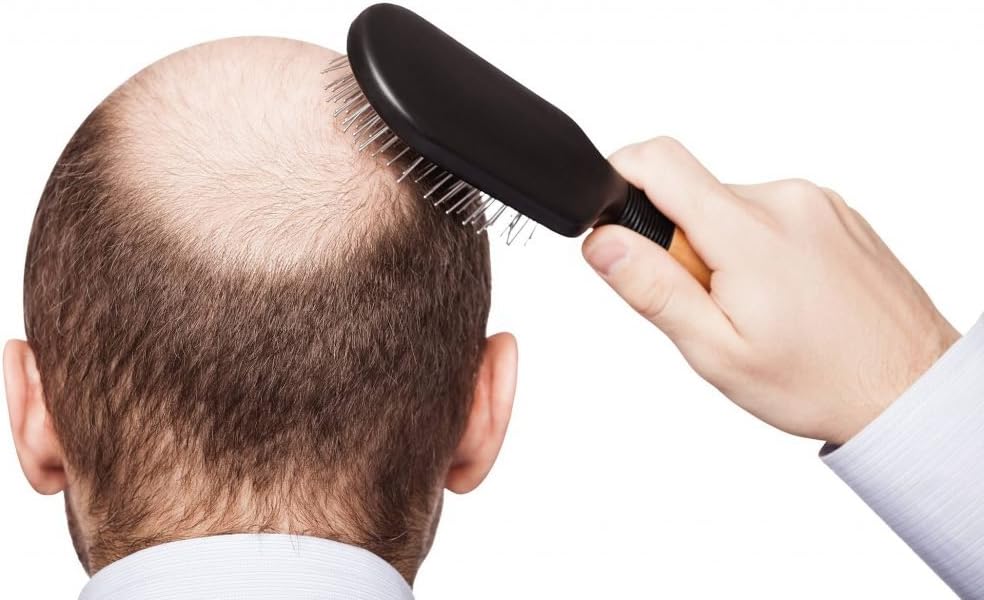 hair-growth-support-vitamins---dht-block-2.jpg