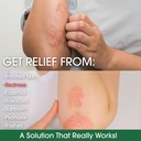 manuka-honey-eczema-cream-moisturizing-l-4.jpg