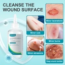 dimora-skin-and-wound-cleanser-otc-first-2.jpg
