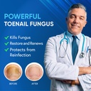 toenail-fungus-treatment-extra-strength--2.jpg