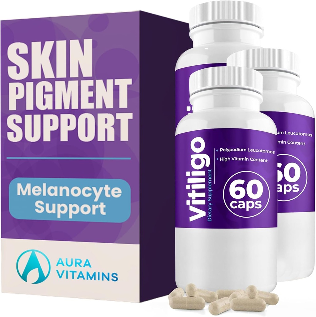 Vitiligo capsule 60 conte | 1 mese | Migliorare il supporto della pigmentazione della pelle e ridurre i punti bianchi | supplemento di vitiligine efficace | Soluzione naturale per le macchie bianche sulla pelle. (3)