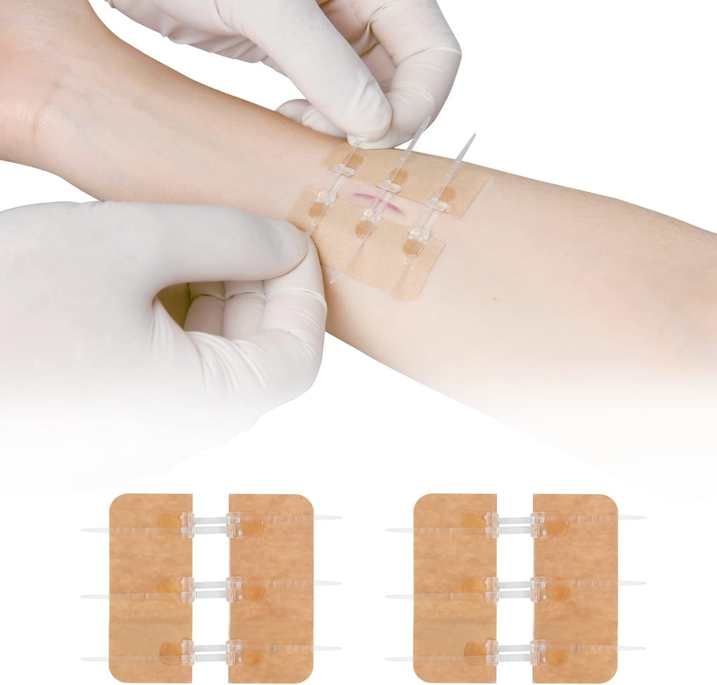 Zip Stitch Laceration Riparazione Senza Stitches Butterfly Bandaids Chiusura rapida - Dispositivo di chiusura guanto di emergenza 2 pezzi(PU)