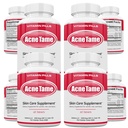 Supplément de pilules d'acné- Pilule de vitamines claires de la peau pour le traitement de la peau huileuse, Blemishes hormonales, Anti-spots et suppléments d'acnes kystiques pour les femmes, les hommes, les adolescents et les adultes- 240 comprimés oraux