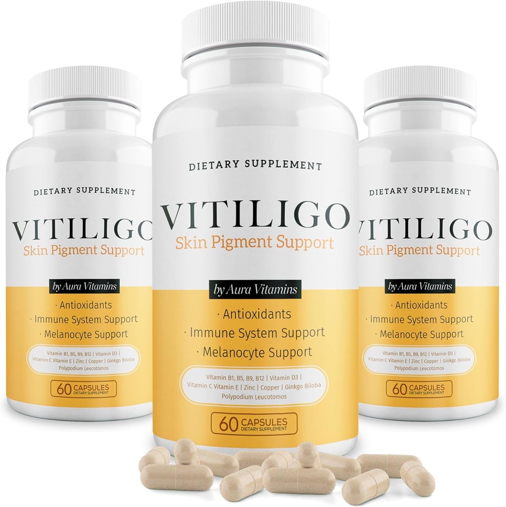 Dermawonder Vitiligo Kapseln 60 Count | Effektive Vitiligo Ergänzung | Reduzieren White Spots und verbessern Hautpigmentierung Unterstützung | Geeignet für alle Haut | Natürliche Lösung für weiße Spots auf (3)