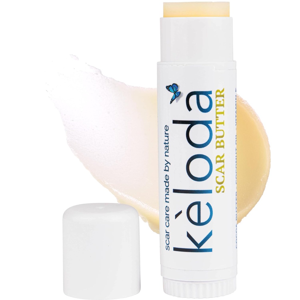 Baume de traitement du beurre, des cicatrices et des kéloïdes kéloïdes, pour les cicatrices chirurgicales et les kéloïdes des piercings, des marques stretch, de l'acné, avec le cacao anti-scar, beurre de karité, noix de coco et huiles de jojoba