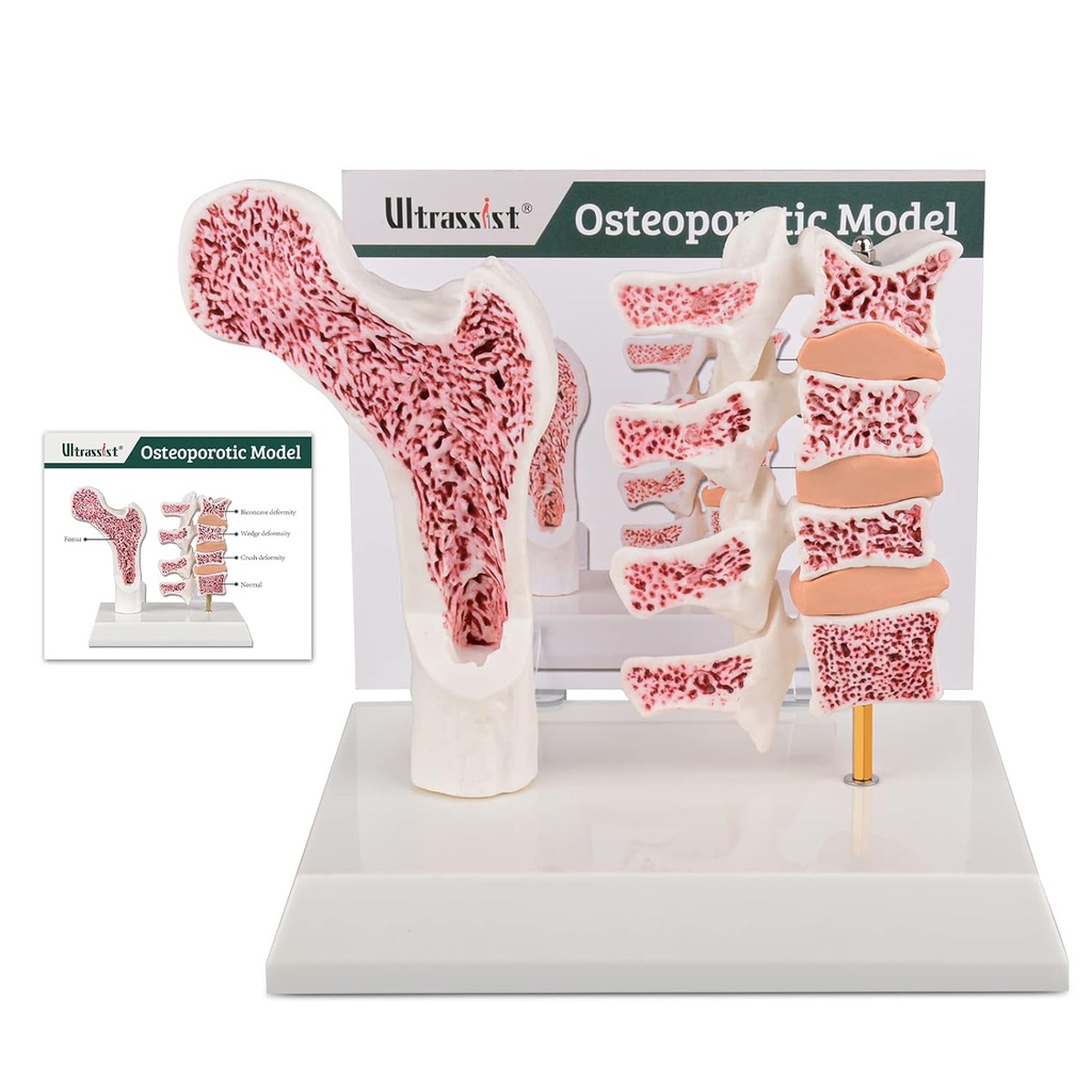 Modèle ultrasiste d'ostéoporose humaine à l'anatomie, modèle de squelette anatomique vertébré avec carte d'étude pour la démonstration de l'enseignement des étudiants en médecine