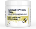 Crema di Venom di api ad alta resistenza, Unguento di eczema disidrotico, Rash di calore, prurito, Eczema, Psoriasi, Leg, Stomach, Piede, Mano, Pelle irritata, Cura di tutta l'età