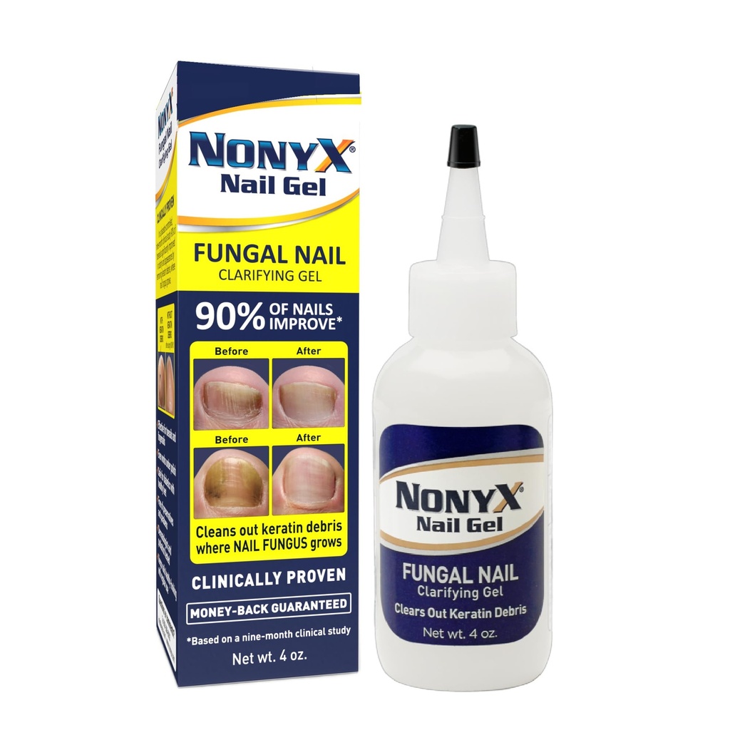 NONYX Fungal Nail Clarifying Gel | Clinical Provenienz für verfärbte, dicke, brüchige, gelbe, gehobene und andere Anzeichen von Fungus-Damaged Toenails | 90% der Nägel verbessern | Über 8 Millionen verkauft
