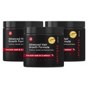 iRestore Advanced Hair Growth Supplement für Frauen, Haar Vitamine für schnellere Haare Regrowth, Best for Hair Loss and Thinning - 1 Monat Versorgung Jeder - 30 Count (Pack of 3) - Schwarz