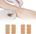 Zip Stitch Schnürung Reparatur ohne Stitches Butterfly Bandaids Quick Clot - Notfall Wound Schließungen Gerät 2 Stück(PU)